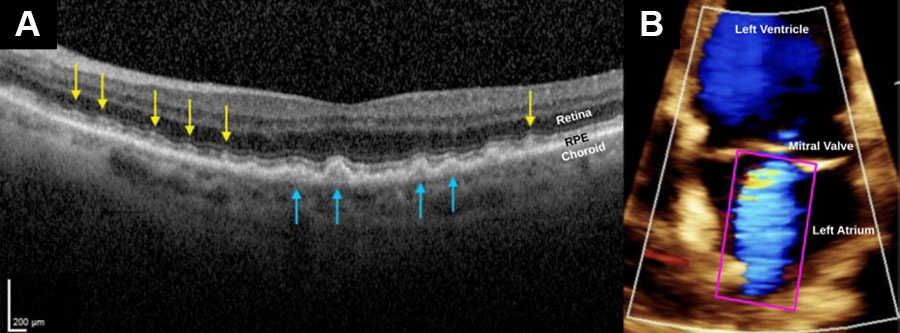 image of sonogram