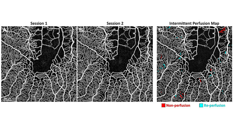 adaptive optics imaging 